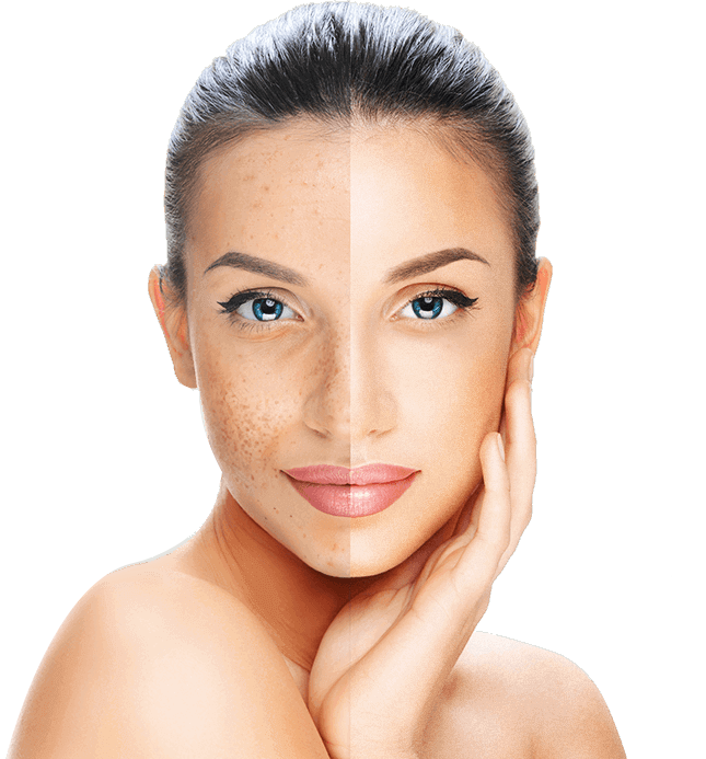 Happy woman with clear skin