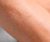 Dry Skin