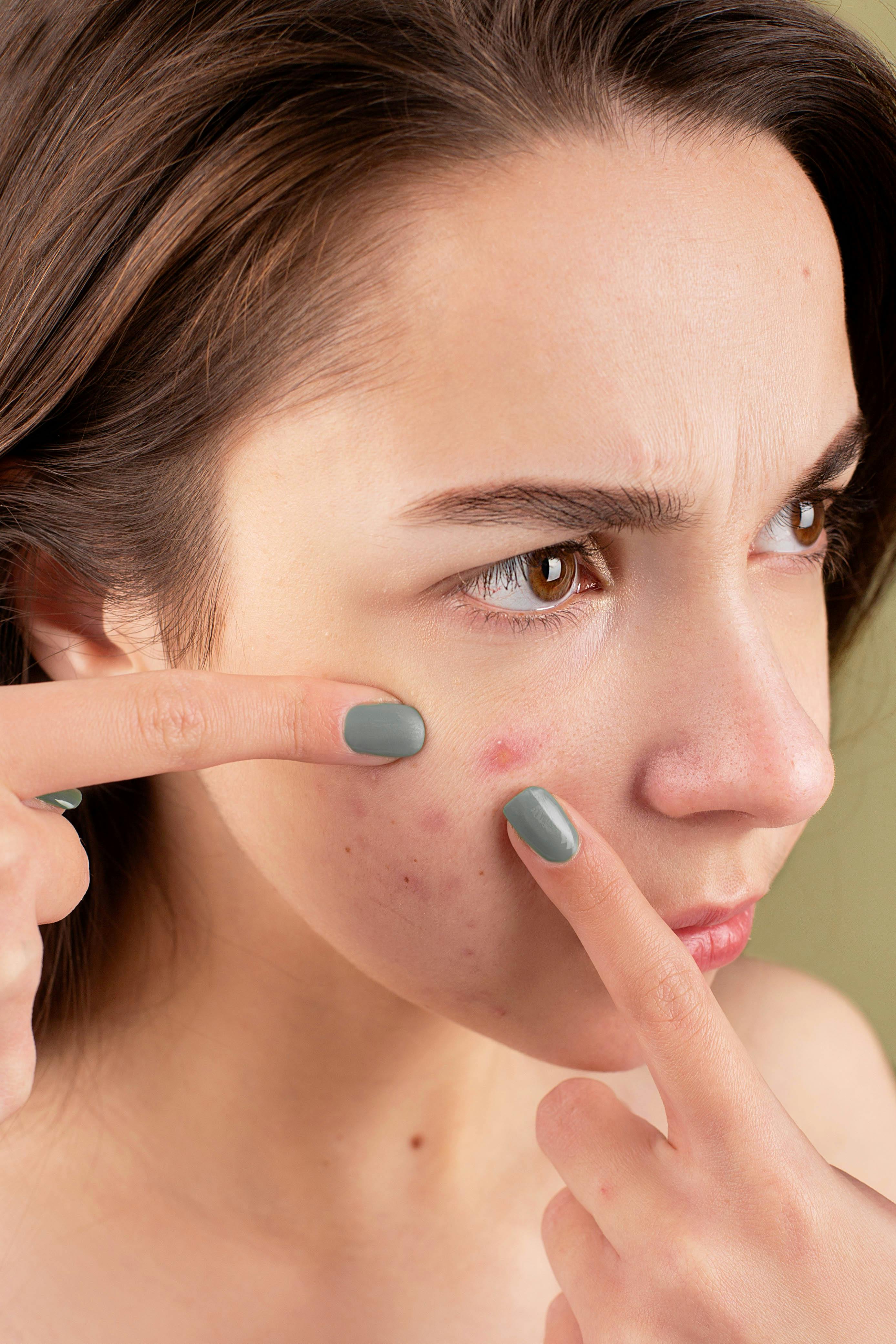 Skin Treatment Visual